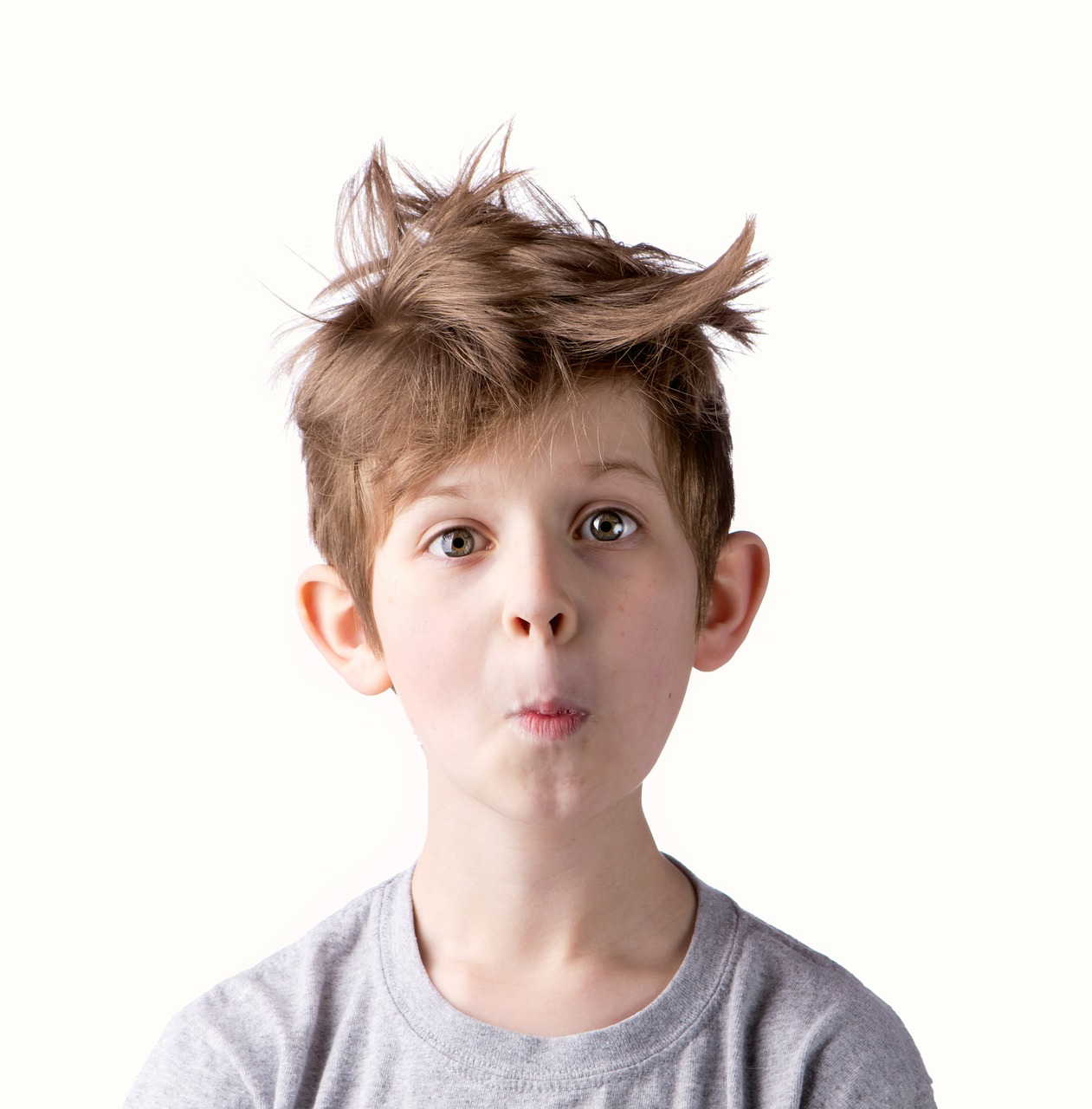 孕妈供卵生的宝宝白癜风初期图片